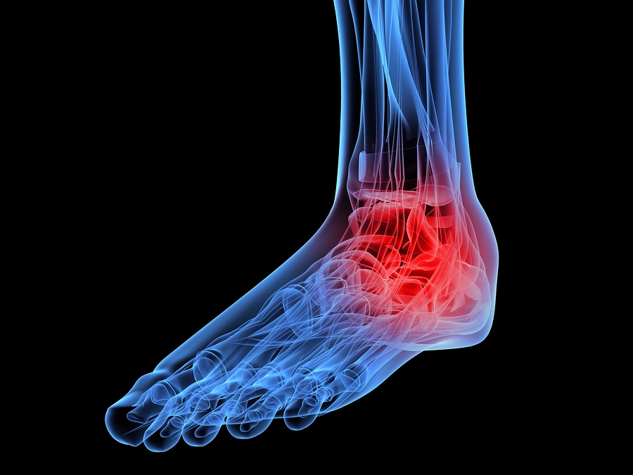 Tarsal Tunnel Syndrome Treatment, Exercises & Best Shoes Orthotic