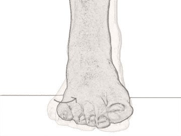 inversion of the foot - image