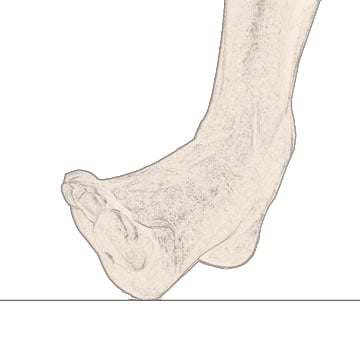 pronation image