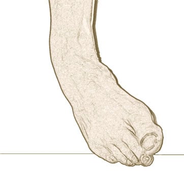 supination image